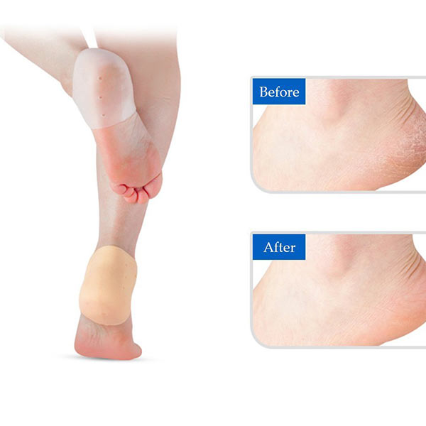 Silicone Heel Bảo vệ cơn đau đớn Insủ bảo vệ tinh thần Foot Care pha pha gót thái ZG -1806